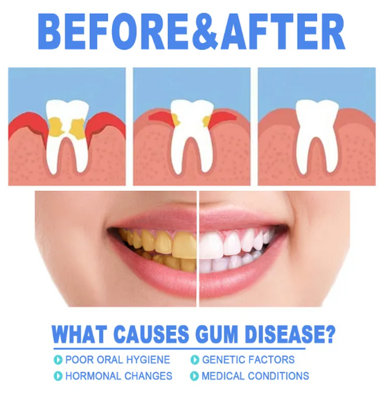 Teeth Repair Gel Sided Tape Transparent